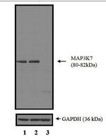 TAK1 Antibody in Western Blot (WB)