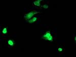 TAL1 Antibody in Immunocytochemistry (ICC/IF)