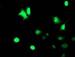 TAL1 Antibody in Immunocytochemistry (ICC/IF)