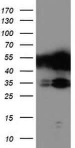 TAL1 Antibody in Western Blot (WB)