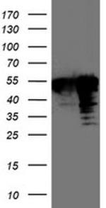 TAL1 Antibody in Western Blot (WB)