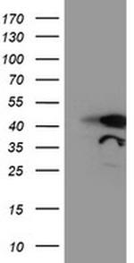 TAL1 Antibody in Western Blot (WB)