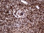 TALDO1 Antibody in Immunohistochemistry (Paraffin) (IHC (P))