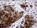 TALDO1 Antibody in Immunohistochemistry (Paraffin) (IHC (P))