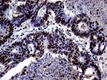 TALDO1 Antibody in Immunohistochemistry (Paraffin) (IHC (P))