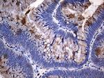 TANK Antibody in Immunohistochemistry (Paraffin) (IHC (P))