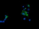 TAPBPL Antibody in Immunocytochemistry (ICC/IF)