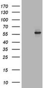 TAPBPL Antibody in Western Blot (WB)