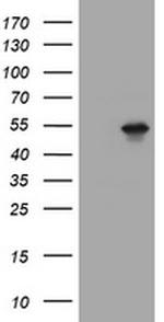 TAPBPL Antibody in Western Blot (WB)