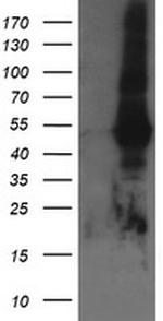 TAPBPL Antibody in Western Blot (WB)