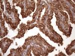 TARBP2 Antibody in Immunohistochemistry (Paraffin) (IHC (P))