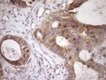 TARBP2 Antibody in Immunohistochemistry (Paraffin) (IHC (P))