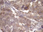 TARBP2 Antibody in Immunohistochemistry (Paraffin) (IHC (P))