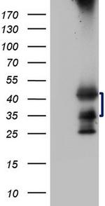 TARBP2 Antibody in Western Blot (WB)