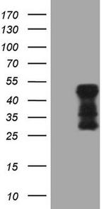 TARBP2 Antibody in Western Blot (WB)