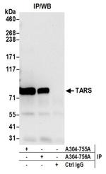 TARS Antibody in Western Blot (WB)