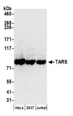 TARS Antibody in Western Blot (WB)