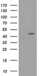 TASP1 Antibody in Western Blot (WB)