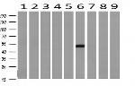 TASP1 Antibody in Western Blot (WB)