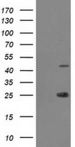 TASP1 Antibody in Western Blot (WB)