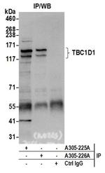 TBC1D1 Antibody in Immunoprecipitation (IP)