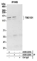 TBC1D1 Antibody in Western Blot (WB)