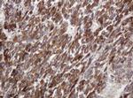 TBC1D13 Antibody in Immunohistochemistry (Paraffin) (IHC (P))