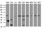 TBC1D13 Antibody in Western Blot (WB)