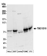 TBC1D15 Antibody in Western Blot (WB)