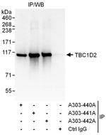 TBC1D2 Antibody in Immunoprecipitation (IP)