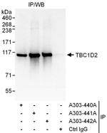 TBC1D2 Antibody in Immunoprecipitation (IP)