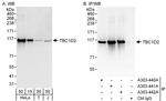 TBC1D2 Antibody in Western Blot (WB)