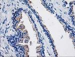 TBC1D21 Antibody in Immunohistochemistry (Paraffin) (IHC (P))