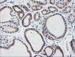 TBC1D21 Antibody in Immunohistochemistry (Paraffin) (IHC (P))