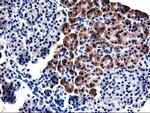 TBC1D21 Antibody in Immunohistochemistry (Paraffin) (IHC (P))