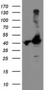 TBC1D21 Antibody in Western Blot (WB)