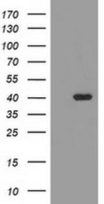 TBC1D21 Antibody in Western Blot (WB)