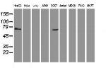 TBC1D21 Antibody in Western Blot (WB)