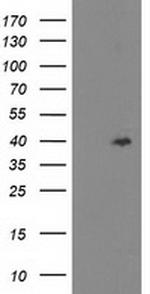 TBC1D21 Antibody in Western Blot (WB)