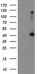 TBC1D21 Antibody in Western Blot (WB)