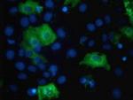 TBC1D4 Antibody in Immunocytochemistry (ICC/IF)