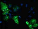 TBC1D4 Antibody in Immunocytochemistry (ICC/IF)