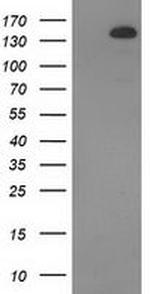 TBC1D4 Antibody in Western Blot (WB)