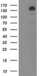 TBC1D4 Antibody in Western Blot (WB)