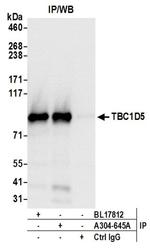 TBC1D5 Antibody in Western Blot (WB)