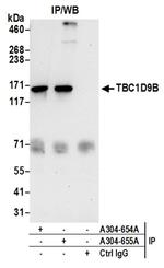 TBC1D9B Antibody in Western Blot (WB)