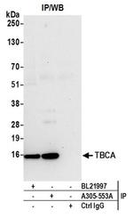 TBCA Antibody in Western Blot (WB)