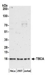 TBCA Antibody in Western Blot (WB)