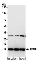 TBCA Antibody in Western Blot (WB)