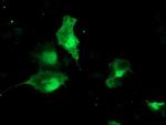 TBCC Antibody in Immunocytochemistry (ICC/IF)